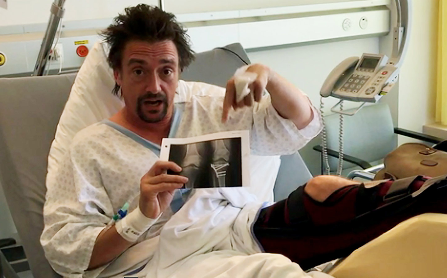 Jeremy Clarkson on Richard Hammond's crash in the Rimac Concept_One electric supercar: Hammond in hospital