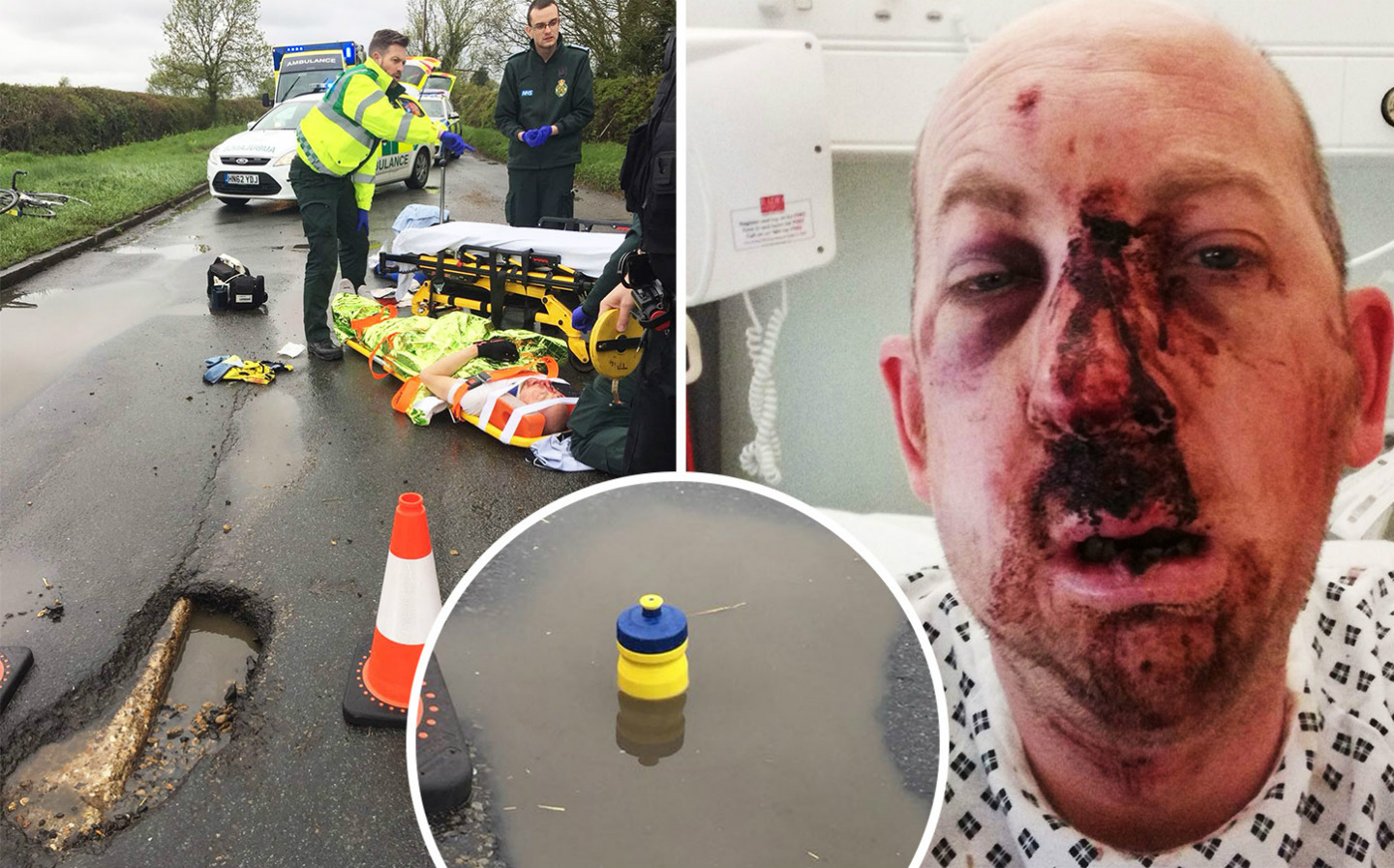 Simon Moss, a 44-year old cyclist, suffered severe injuries to his face, a broken jaw and a fractured spine after being thrown from his bike